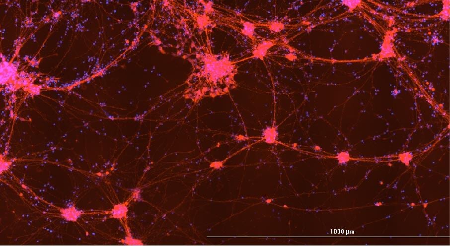 CRISPR-edited nerve cells