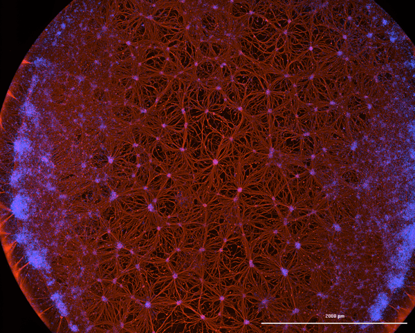 Crispr Edited verve cells