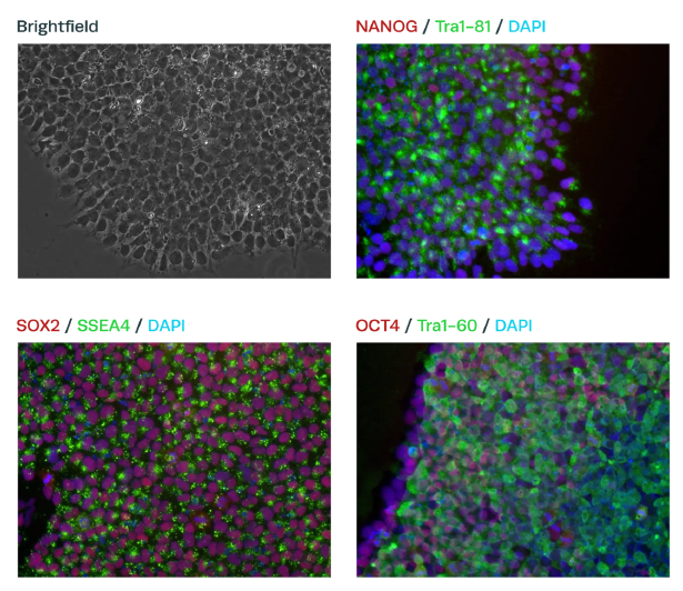 iPSC Pluripotency