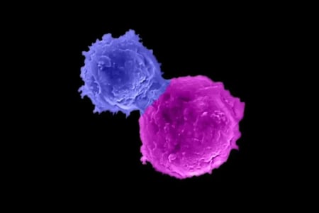 Microscopy image showing an allogeneic BCMA-targeting CAR-armed and IL-15-enhanced NKT cell attacking a human multiple myeloma cell