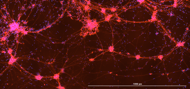 CRISPR edited nerve cells