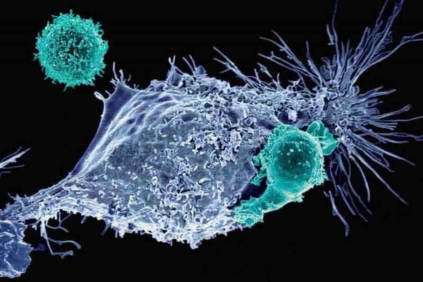 Mesothelin-specific CAR T cells attacking a cancer cell